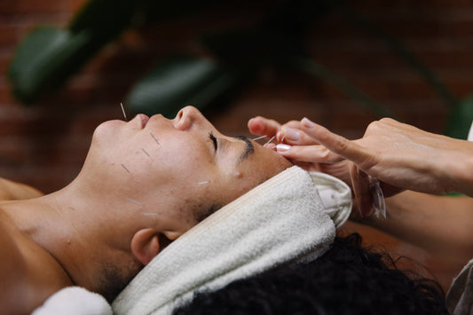 Cosmetic Acupuncture in Vancouver: A Natural Approach to Facial Rejuvenation