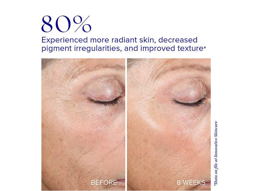 iS Clinical: Active Peel System
