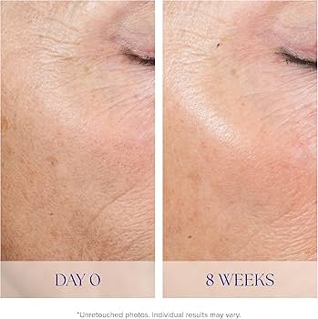 iS Clinical: Active Peel System