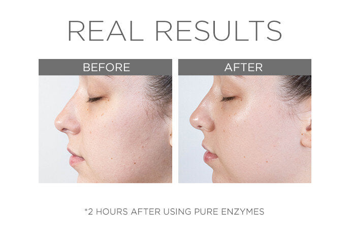 Pure Enzymes- Cranberry Exfoliating Mask