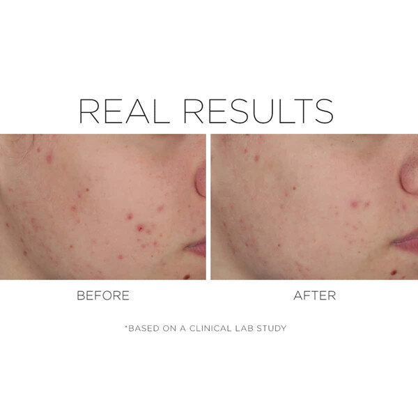 Shineless - Oil Free Moisturizer
