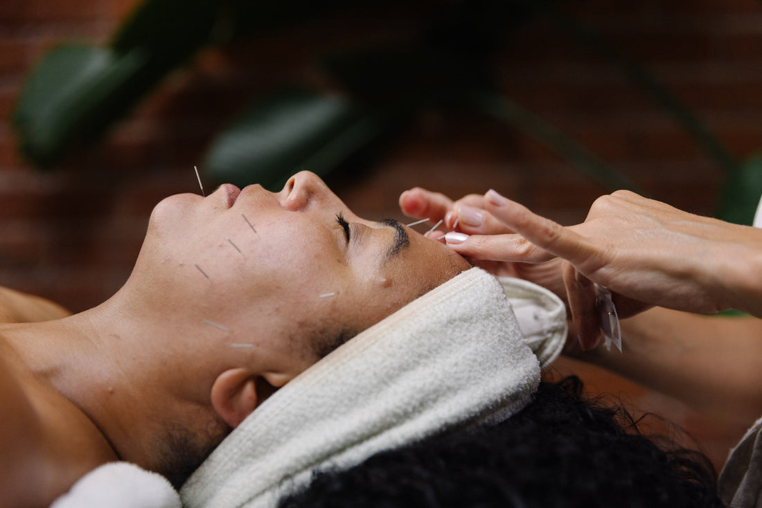 Cosmetic Acupuncture in Vancouver: A Natural Approach to Facial Rejuvenation