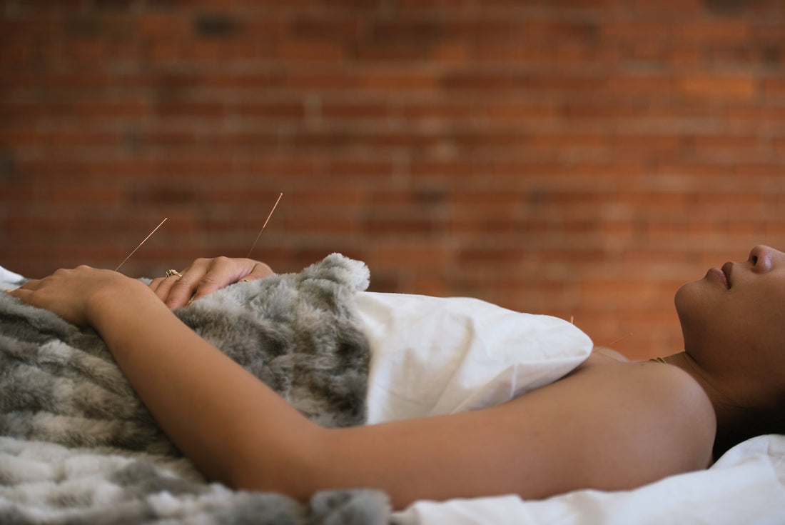 Acupuncture for Pain Relief in Vancouver — Natural, effective care for acute and chronic pain