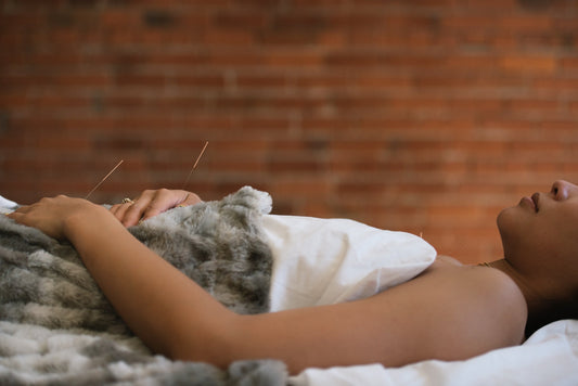 Acupuncture for Pain Relief in Vancouver — Natural, effective care for acute and chronic pain