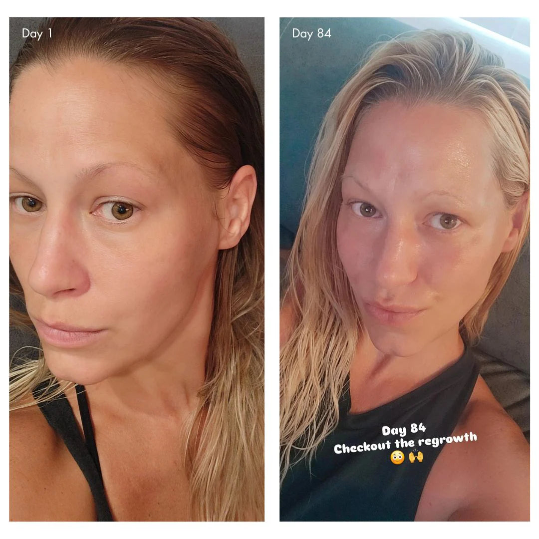 Before and after comparison of a woman's hair growth over 84 days.