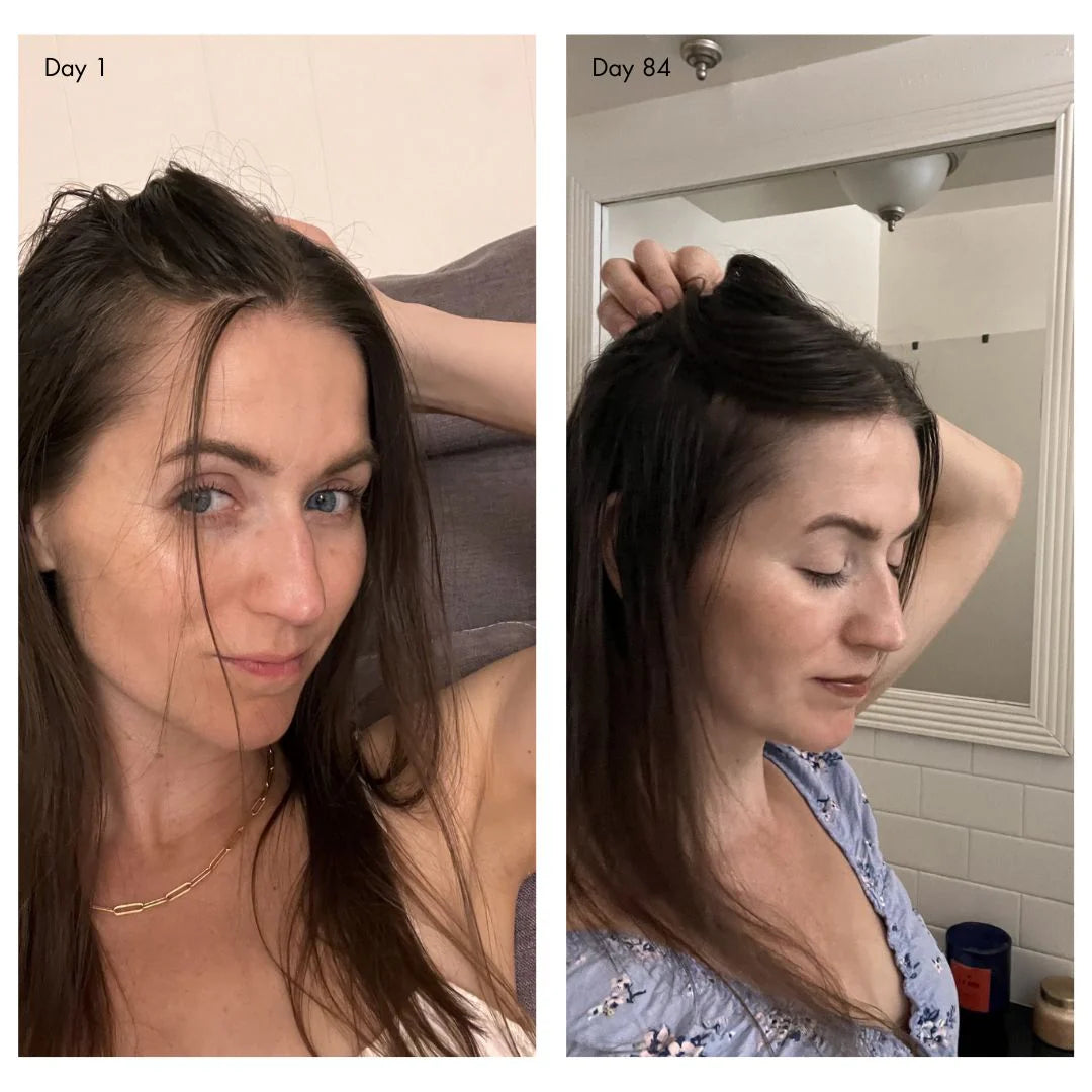 Before and after comparison of a woman's hair growth over 84 days.