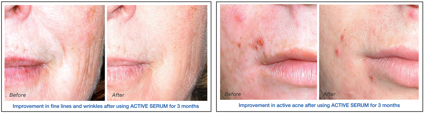 Active Serum