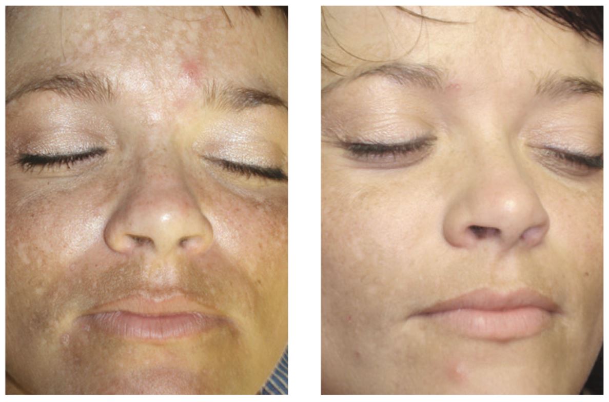 Brightening Serum