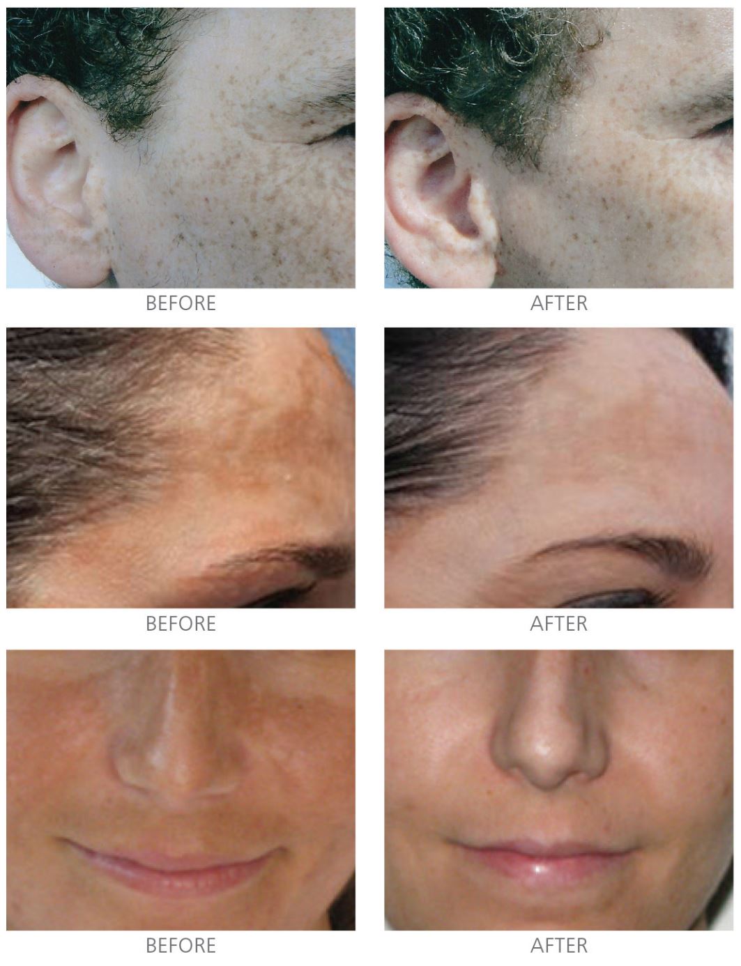 Brightening Serum
