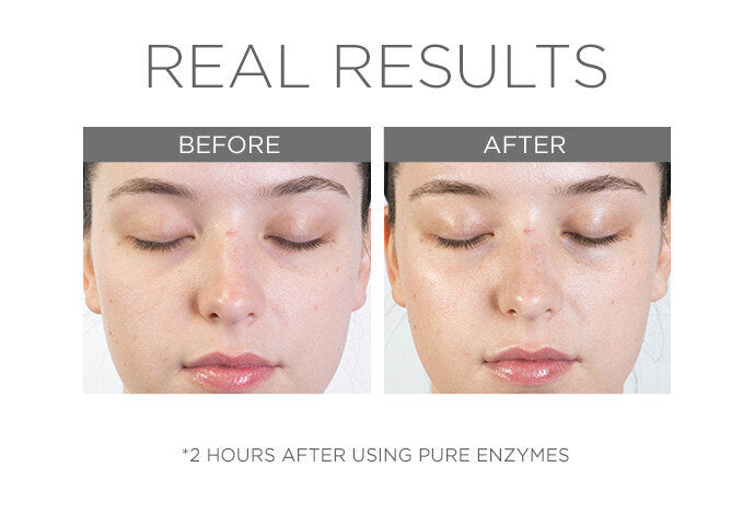 Pure Enzymes- Cranberry Exfoliating Mask