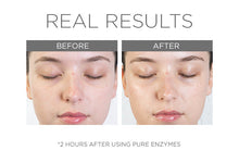 Load image into Gallery viewer, Pure Enzymes- Cranberry Exfoliating Mask
