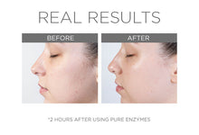Load image into Gallery viewer, Pure Enzymes- Cranberry Exfoliating Mask
